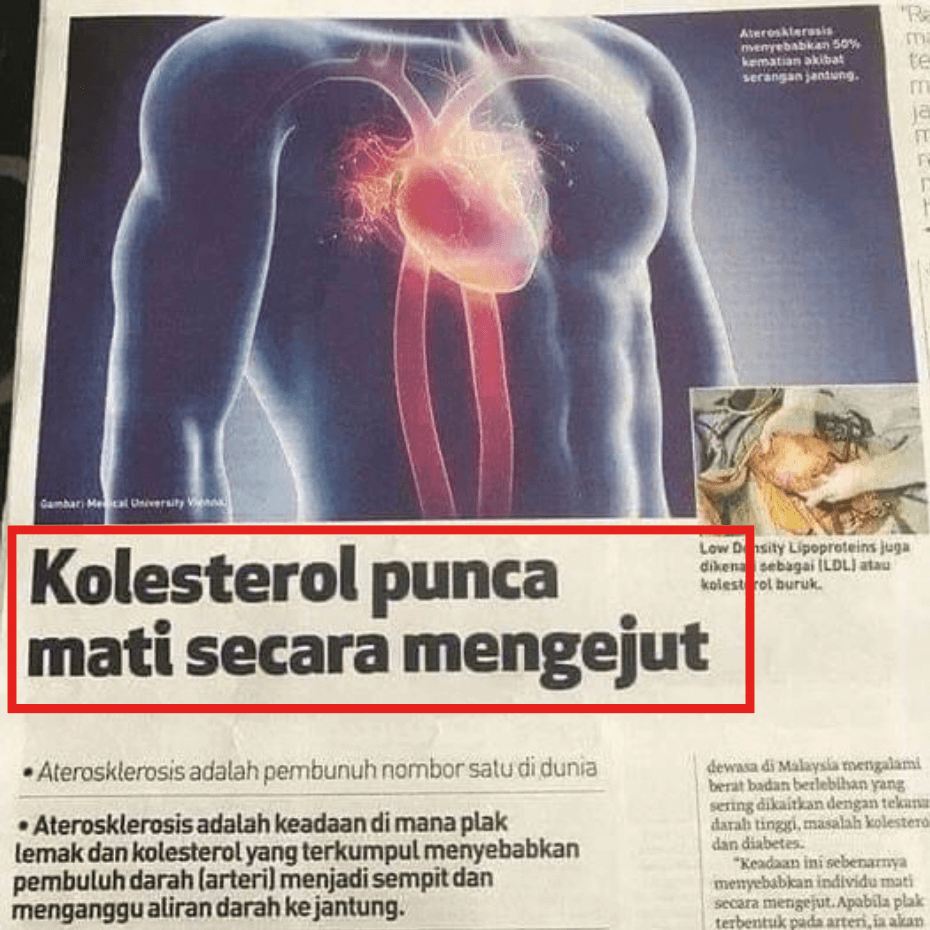 Kolesterol Tinggi
